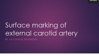 surface marking of external carotid artery  surface anatomy of external carotid artery [upl. by Pamela187]