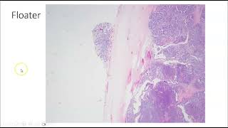 Artifacts in Histopathology and Cytopathology [upl. by Merrell]