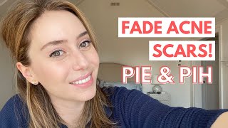 How To Fade Acne Scars Post Inflammatory Erythema amp Post Inflammatory Hyperpigmentation [upl. by Fenton]