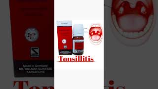 Tonsillitis treatment Dr Mehwish Akhter Homeopathic healthcare alternativemedicine anatomy [upl. by Dorthea]