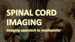 Spinal Cord Imaging Imaging approach to Myelopathy [upl. by Orozco622]