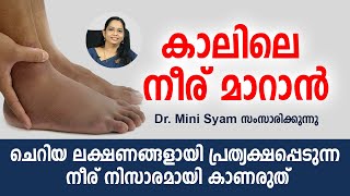 കാലിലെ നീര് നിസാരമായി കാണരുത്  Malayalam Health Tips [upl. by Scrivens]