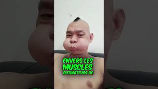 Une condition curieuse mais inoffensive tiktok viral shorts [upl. by Eityak]