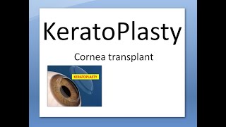 Ophthalmology 145 a Keratoplasty Cornea Transplant Eye donation Donor Surgery Indication Type Define [upl. by Ganiats411]