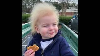 Boy With Rare Uncombable Hair Syndrome Brings a Smile to Faces [upl. by Boyse]