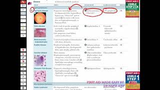 Lysosomal Storage Diseases USMLE First Aid Lecture [upl. by Eryn887]