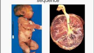 Medical School Pathology Chapter 10b [upl. by Ellednahs]