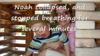 Late Infantile Batten Disease [upl. by Lough716]