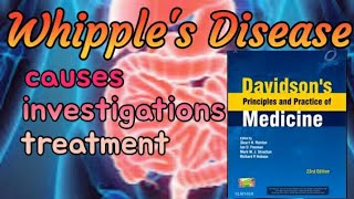 Whipples Disease made easyWhipple disease symptoms treatment prognosisUrduhindi [upl. by Kamila]