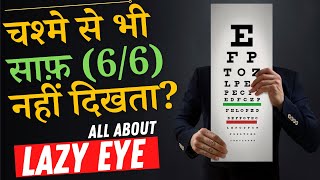 What is A LAZY EYE Amblyopia and How to Fix it  Amblyopia Lazy Eye Causes amp Treatment in Hindi [upl. by Chanda]