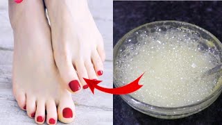 Feet cleaning Home Remedy  DIY Home Made Mixture For Clean and Glowing Feet [upl. by Eillen753]