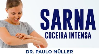 Sarna ou Escabiose – Doença que Causa Coceira Intensa – Dr Paulo Müller Dermatologista [upl. by Ireg]