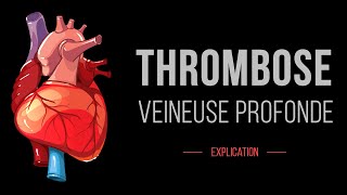 Thrombose Veineuse Profonde  Cardiologie  Détails [upl. by Tyson]