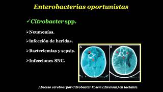 Enterobacterias oportunistas Acinetobacter spp [upl. by Ldnek]