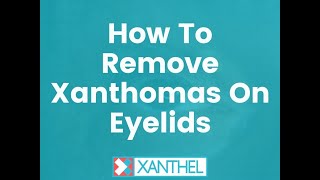 How To Remove Xanthomas On Eyelids  Its easy when you know how   By XANTHEL ® [upl. by Lleroj]