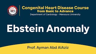 Ebstein Anomaly  Prof Ayman Abd AlAziz [upl. by Brecher737]