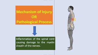 Physiotherapy in Transverse Myelitis [upl. by Eibrad]