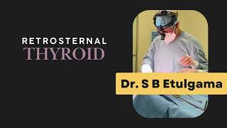 Removal of retrosternal thyroid gland by Dr S B Etulgama ENT Surgeon in Kandy Sri Lanka [upl. by Saduj]