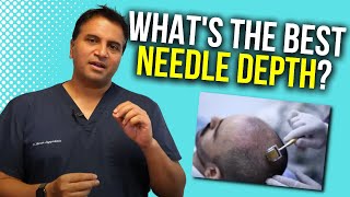 Dermarolling Optimal Needle Depth  The Hair Loss Show [upl. by Hansiain329]