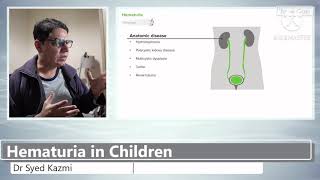 Hematuria in Children [upl. by Atina]