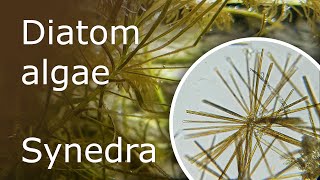 All About Diatom Algae Synedra in the Aquarium Description Causes and How to Get Rid of It [upl. by Eiramyelhsa864]