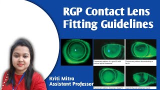 RGP CONTACT LENS  FITTING GUIDELINES [upl. by Aisela]