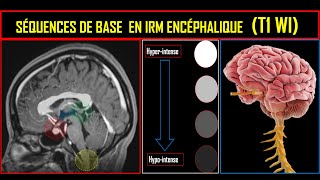 Séquences de base en IRM encéphalique Séquence T1 [upl. by Schofield796]