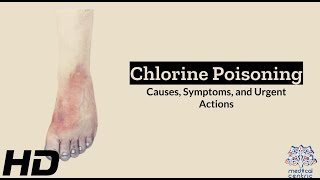 Chlorine Poisoning Signs and LifeSaving Measures [upl. by Anet]