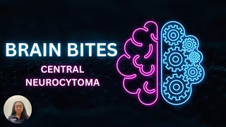 Brain Bites  Central Neurocytoma [upl. by Euqinue502]