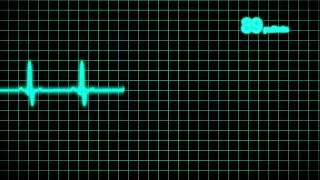 Cardiogram 1080p [upl. by Viehmann360]