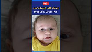 बच्चों को सबसे गंभीर बीमारी Blue baby syndromeriteshjaiswalsir science short viral sanskritiias [upl. by Enerual]