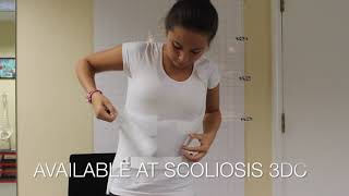 CheneauGensingen Scoliosis Brace  Easy to Put On [upl. by Winston]