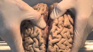 Introduction Neuroanatomy Video Lab  Brain Dissections [upl. by Enenstein604]