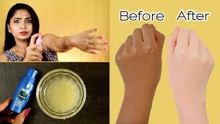 Simple Full Body Whitening Formula Easy amp 100 Effective  Rabia Skincare [upl. by Tlevesor]