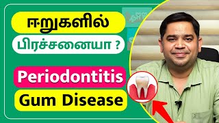 ஈறுகளில் பிரச்சனையா  Periodontitis Gum Disease  Dr Abisheik Johnson Babu  Trinity Dental Clinic [upl. by Baten318]