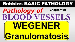 Ch10  WEGENER GRANULOMATOSIS  Blood Vessel Pathology  Robbins Lectures [upl. by Croft]