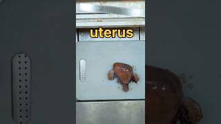 Uterus with bilateral tubes and ovaries 🙄 [upl. by Greysun290]