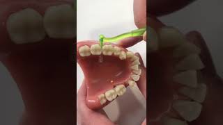 Using an Interdental Brush [upl. by Rednirah]