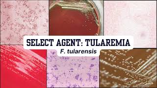 Morphology Moments  Tularemia [upl. by Os]