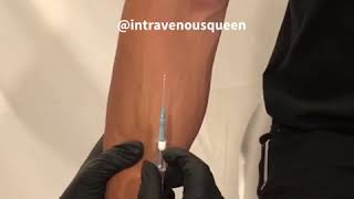 Prevent Veins From Blowing And Thumb Maneuver by Intravenous Queen [upl. by Eannyl]