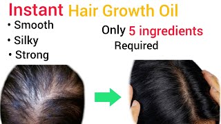 Instant Hair Growth Oil  7 Days Challenge  AntiDandruff Oil  Strong And Healthy Hair [upl. by Xavler]