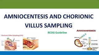 Amniocentesis and Chorionic Villus Sampling RCOG Guideline [upl. by Oicam]