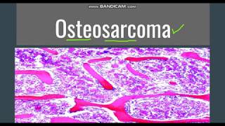 Osteosarcoma GeneralMorphology SubtypesClinical features [upl. by Iadam]