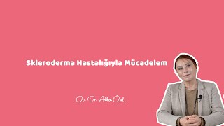 SKLERODERMA HASTALIĞIYLA MÜCADELEM 1  Op Dr Akben Özel [upl. by Serilda]