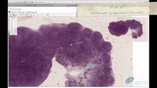 Histology Helper  Lymphoid Tissue Histology [upl. by Comethuauc635]