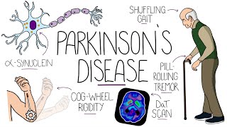 Understanding Parkinsons Disease Including Direct and Indirect Pathways [upl. by Droflim]