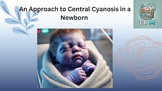 An Approach to Central Cyanosis in a Newborn [upl. by Kostival291]