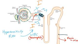 Acute Kidney Injury for the USMLE Step 1 [upl. by Ettezel]