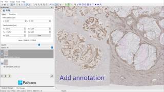 Comparing staining on multiple IHC slides [upl. by Idolem564]