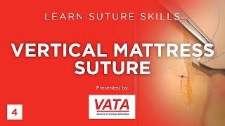 Vertical Mattress Suture  Learn Suture Techniques  VATA [upl. by Enahsed]